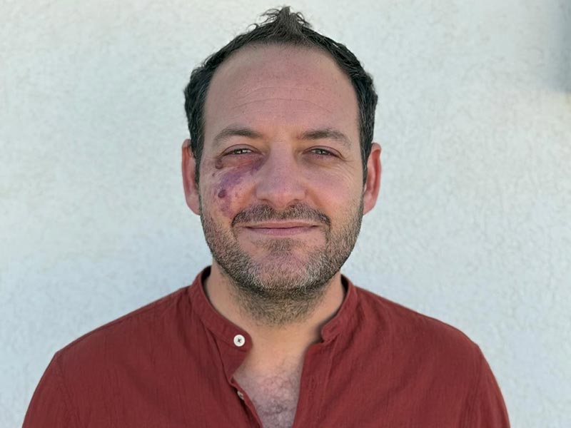 Yoav Martin - Cognitive behavior physiotherapist